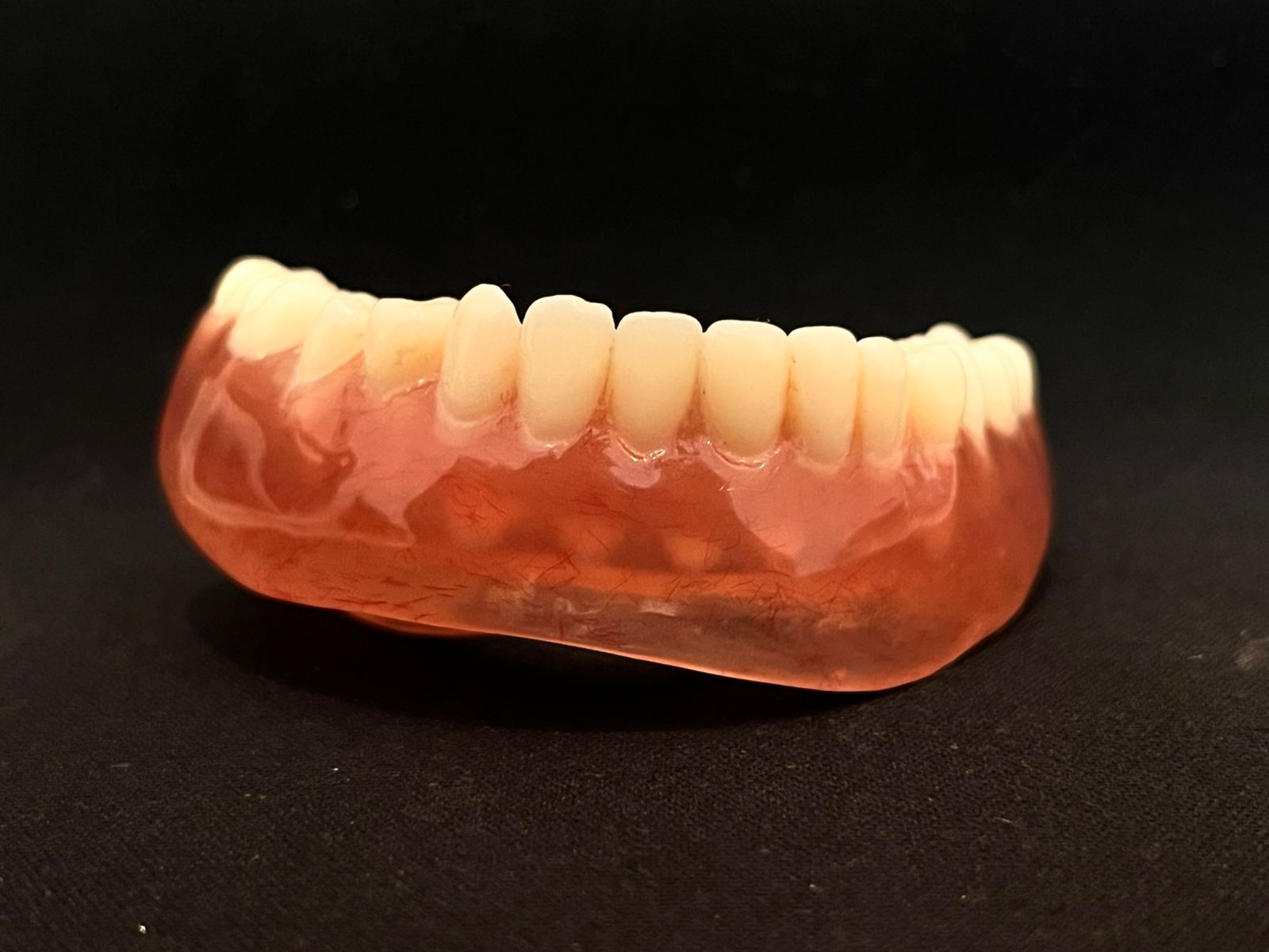 Custom-crafted denture